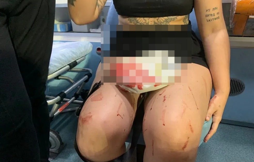 Se a moda pega: Mulher nega compartilhar equipamento de academia e acaba ferida na cabeça em Natal