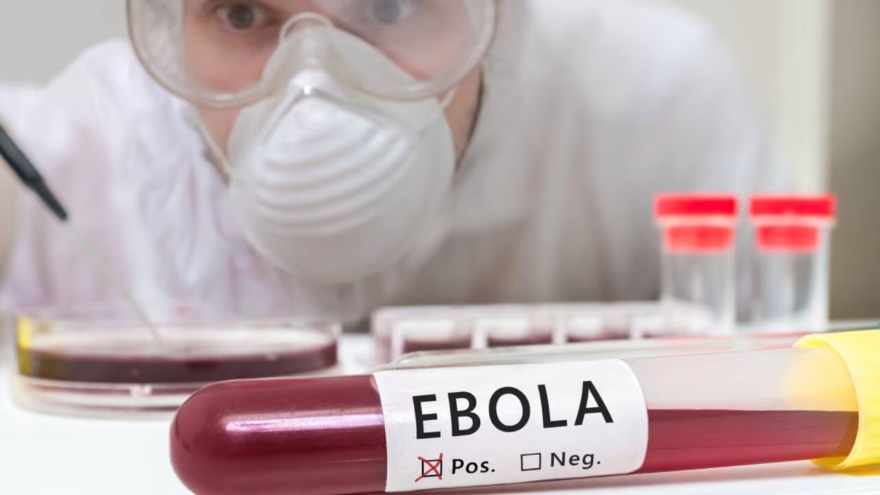 ebola | Créditos: depositphotos.com / vchalup2